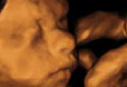 Diamond 3D/4D scan