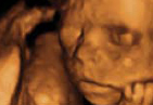 Sapphire 3D/4D scan
