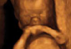 Emerald 3D/4D scan